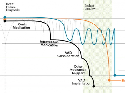 VAD Transplant Chart